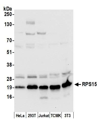 RPS15 / Ribosomal Protein S15 Antibody (aa50-100)