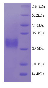 Aequorea victoria GFP Protein (Recombinant His)