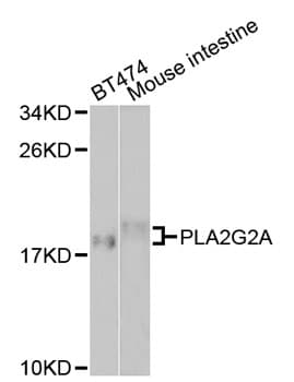 Polyclonal Rabbit anti-Human PLA2G2A / SPLA2 Antibody (IHC, WB)