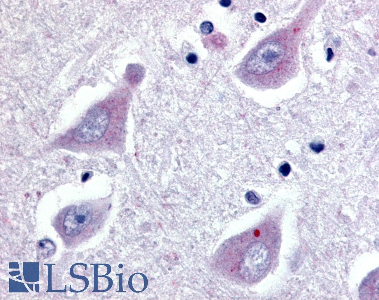 PathPlus™ GPER1 / GPR30 Antibody (Extracellular Domain)