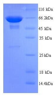 Human CD45 / LCA Protein (Recombinant His)