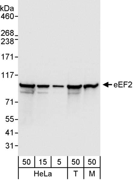 Polyclonal Rabbit anti-Human EEF2 / Elongation Factor 2 Antibody (aa808-858, IHC, WB)