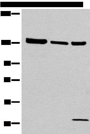 Polyclonal Rabbit anti-Human EPHA6 / EPH Receptor A6 Antibody (IHC, WB)