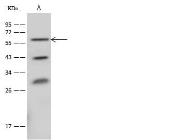 Polyclonal Rabbit anti-Human CD39 Antibody (Preservative Free, WB)