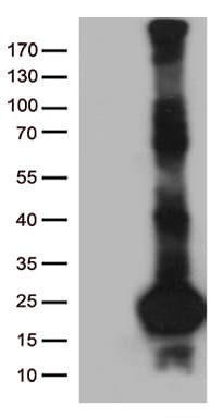 Monoclonal Mouse anti-Human SCP2D1 / C20orf79 Antibody (clone OTI2B5, WB)
