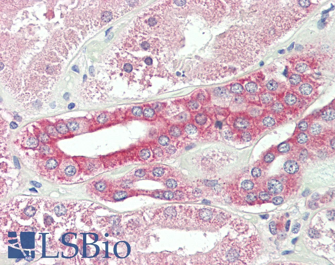 SNX3 Antibody (FITC)