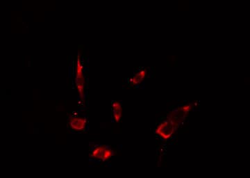 Polyclonal Rabbit anti-Human VPS26B Antibody (IF, WB)