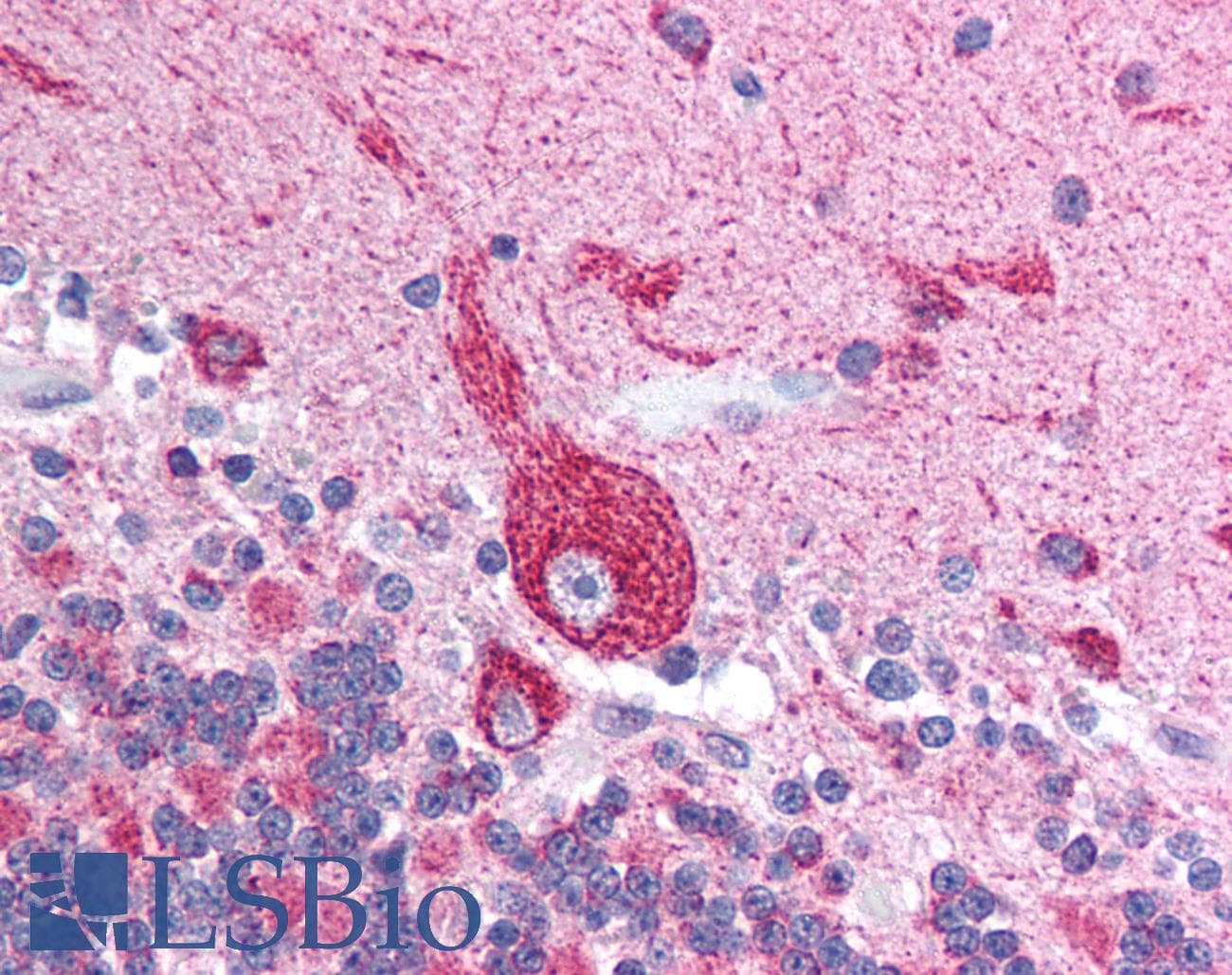 VDAC2 Antibody (N-Terminus)