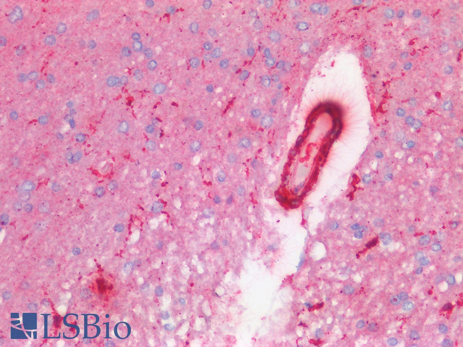 IHC-plus™ Monoclonal Mouse anti-Bovine CAPN1 / Calpain 1 Antibody (clone 15C10, IHC, WB)