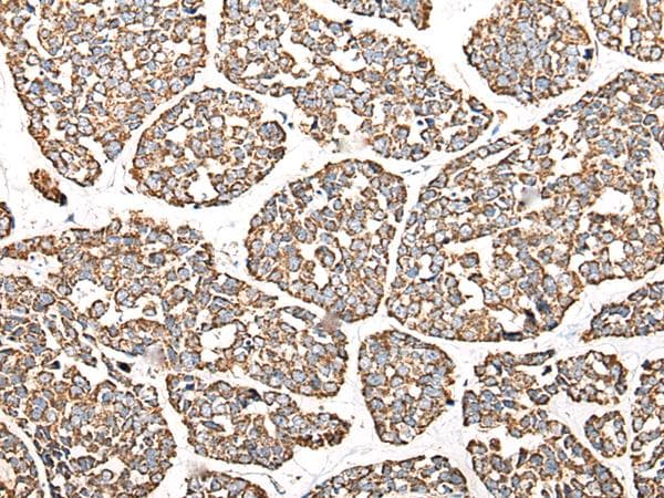 CALB1 / Calbindin Antibody