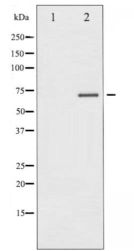ER Alpha / Estrogen Receptor Antibody (phospho-Ser104)