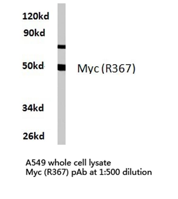 MYC / c-Myc Antibody (Arg367)