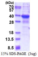 Human TGIF2LX Protein (Recombinant His)