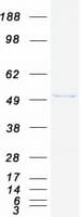 Human SKD1 / VPS4B Protein (Recombinant Myc-DDK (Flag))