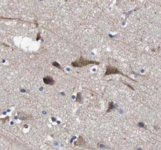 PVALB / Parvalbumin Antibody