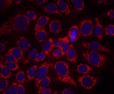 ERBB2 / HER2 Antibody
