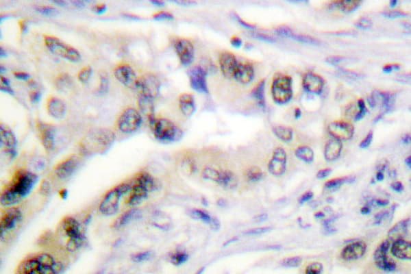 IGF2R / CD222 Antibody (Phe2480)