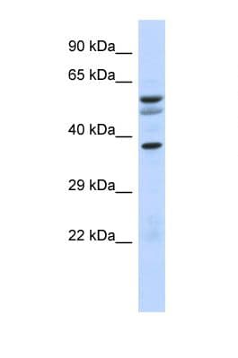 NOC4L Antibody (aa25-74)