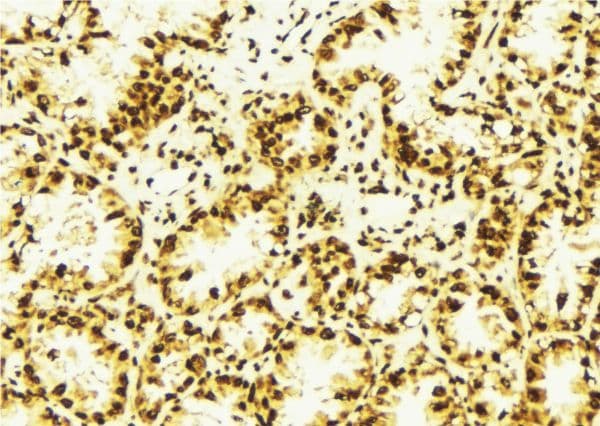ASH2L / ASH2 Antibody
