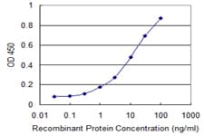 IHC-plus™ RBM3 Antibody (clone 4D6)