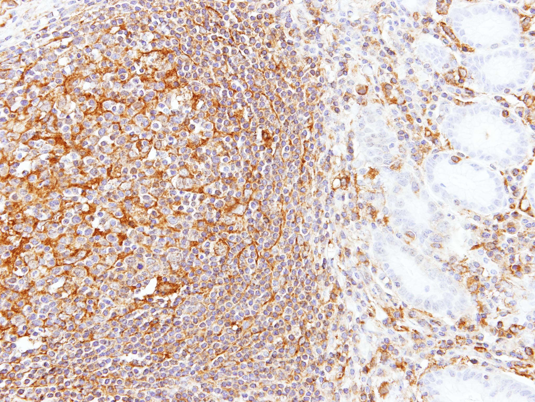 LBP Antibody (aa166-467)