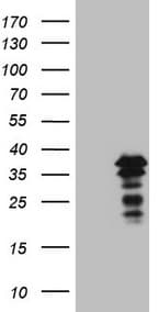 POU2AF1 / BOB1 Antibody (clone OTI3A5)