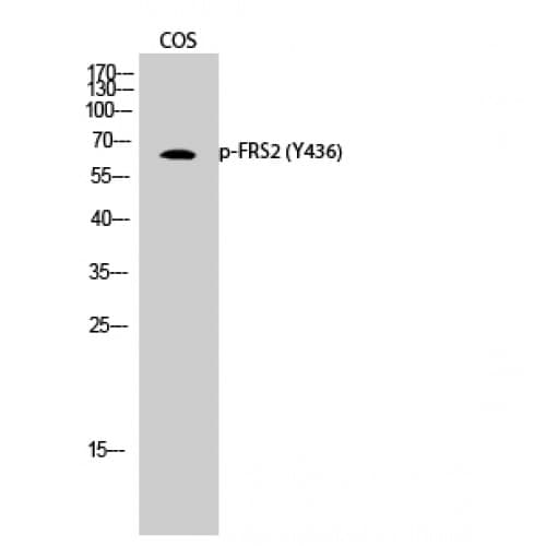 FRS2 Antibody (380-460 aa)