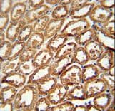 DEGS2 Antibody (aa261-290)