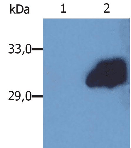 SOCS3 Antibody (clone SO1)