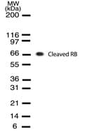 RB1 / Retinoblastoma / RB Antibody (clone 172C1094)