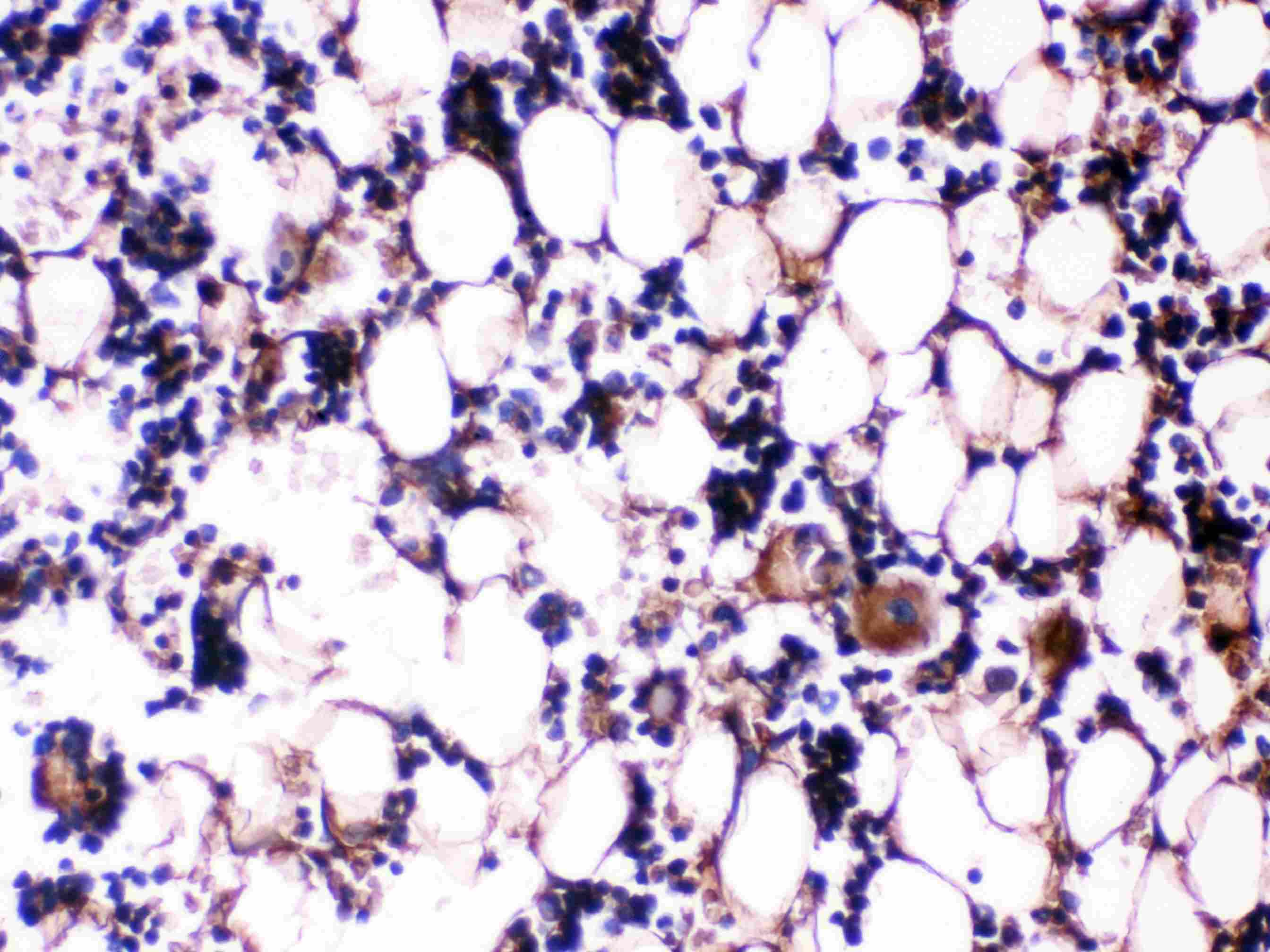 Polyclonal Rabbit anti-Rat Osteocalcin Antibody (IHC)
