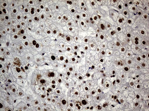 Monoclonal Mouse anti-Human HNRNPH1 / hnRNP H Antibody (clone OTI1H3, IHC, WB)