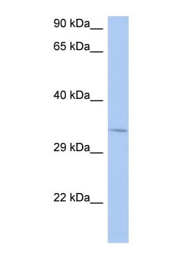 NAPB / SNAPB Antibody (N-Terminus)