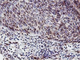 GOLM1 / GP73 / GOLPH2 Antibody (clone OTI4B12)