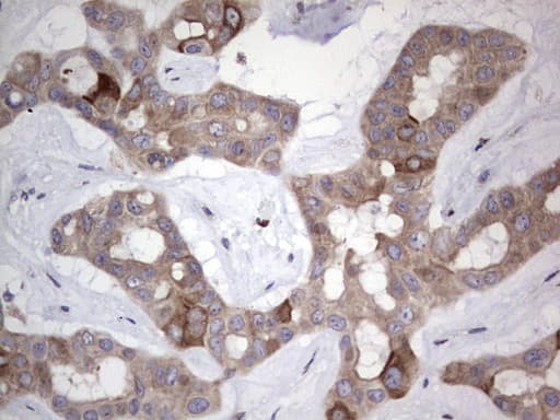 Monoclonal Mouse anti-Human R1 / RRM1 Antibody (clone OTI1F9, aa541-792, IHC)