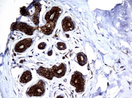 NME1 / NM23 Antibody (clone OTI7D6)