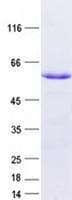 Human SLC25A36 Protein (Recombinant GST, N-terminus + His, C-terminus)
