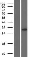 EPCAM Protein (Over-Expression Lysate Myc-DDK (Flag))