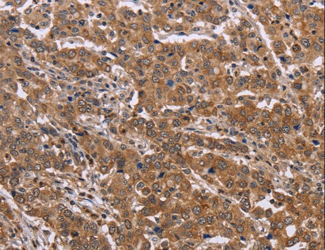 FAAH2 Antibody