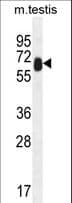 TTC39B Antibody (aa625-654)