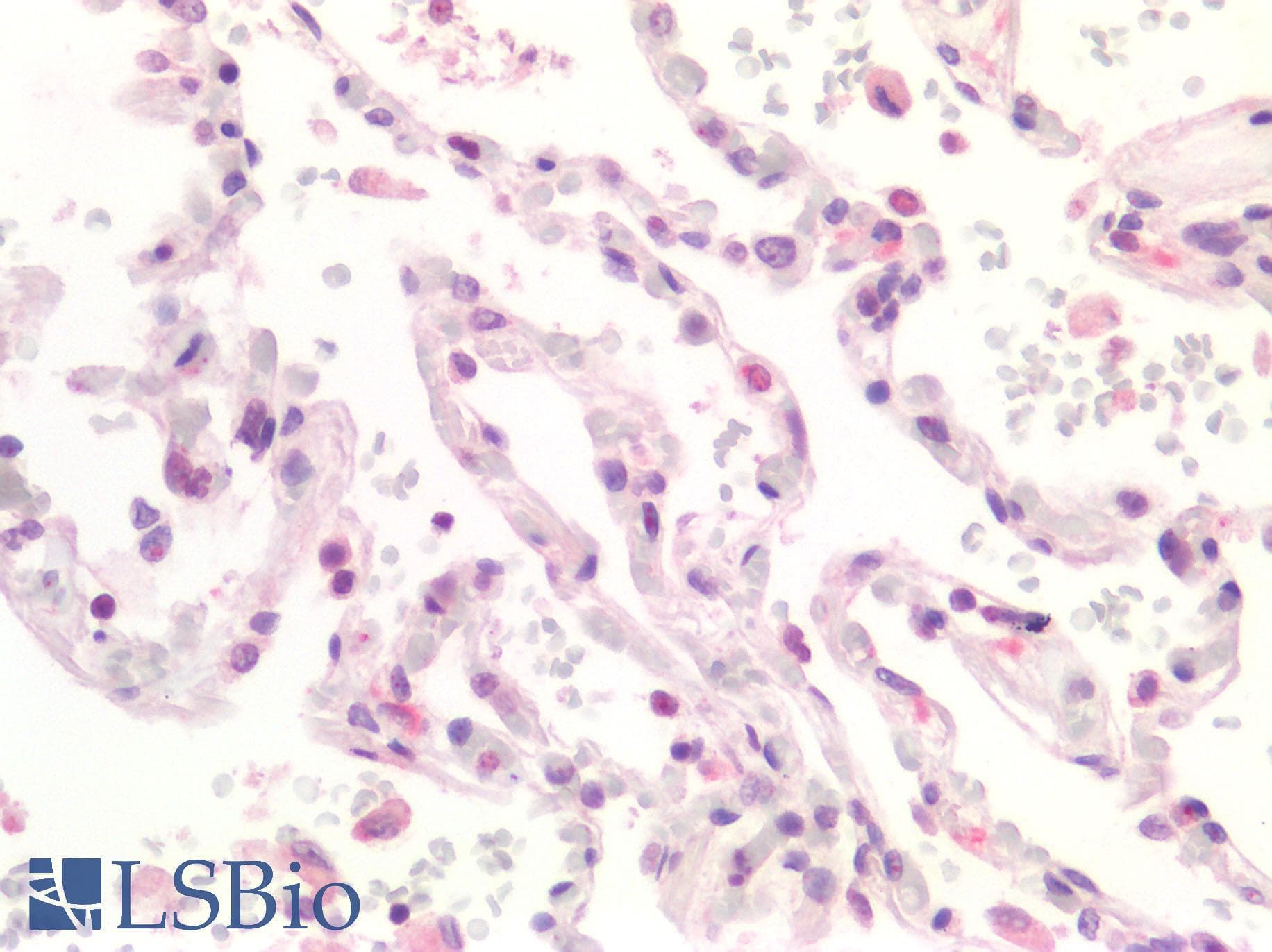 IHC-plus™ Polyclonal Rabbit anti-Human HPSE / Heparanase Antibody (IHC, WB)