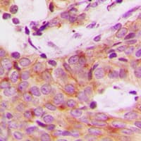 Polyclonal Rabbit anti-Human RPS6KB1 / P70S6K / S6K Antibody (phospho-Ser447, IHC, IF, WB)