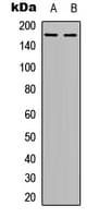 Polyclonal Rabbit anti-Human TEK / TIE2 Antibody (C-Terminus, WB)