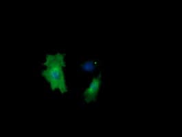 Monoclonal Mouse anti-Human CTAG1B / NY-ESO-1 Antibody (clone OTI4C8, Carrier-free, IHC, IF, WB)