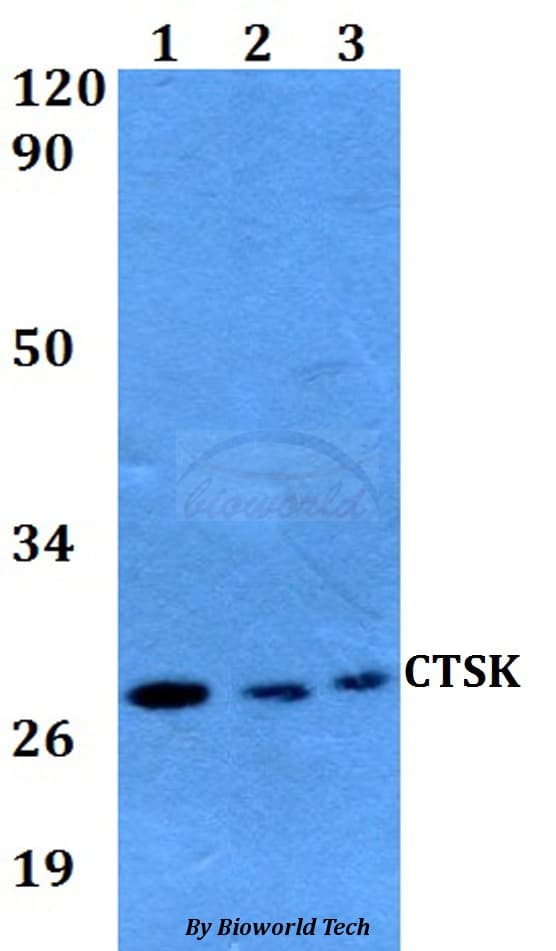 CTSK / Cathepsin K Antibody