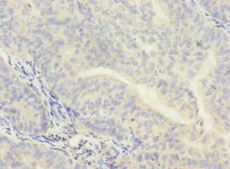 NAR / CPSF4 Antibody
