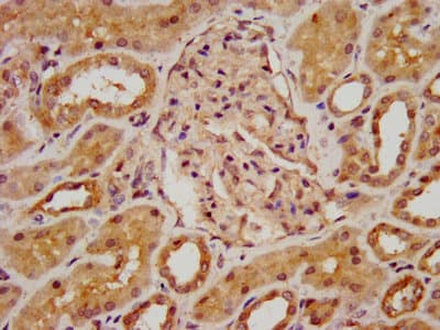 BAZ2B Antibody