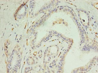 DIP2A Antibody