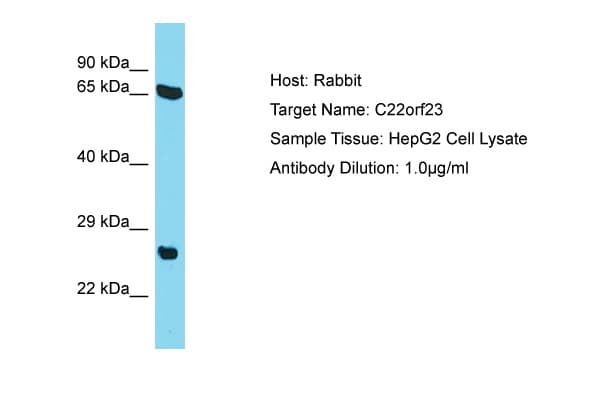 C22orf23 Antibody (aa87-136)