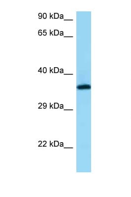 Polyclonal Rabbit anti-Human RGR Antibody (aa76-125, WB)